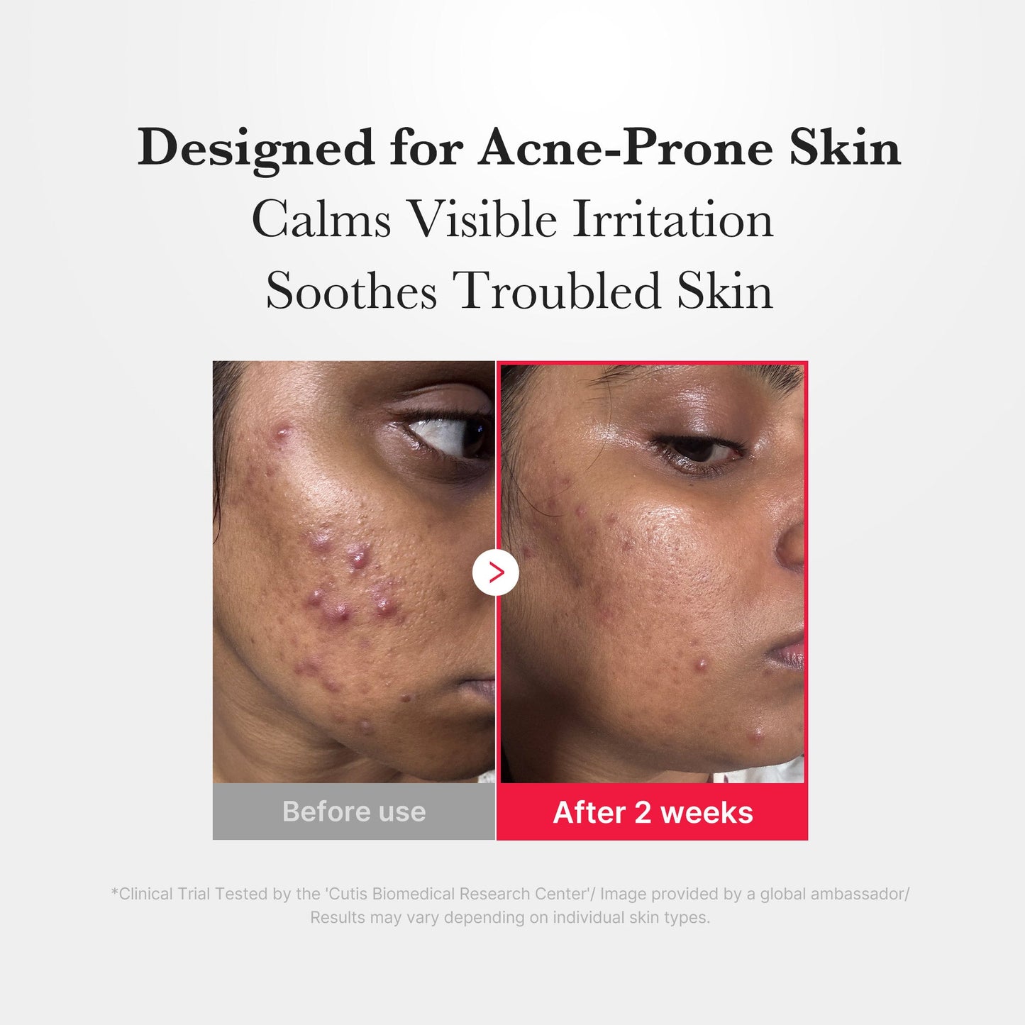 Hypochlorous Acid Power Soothing Spray